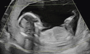 Animated GIF of a baby in the womb